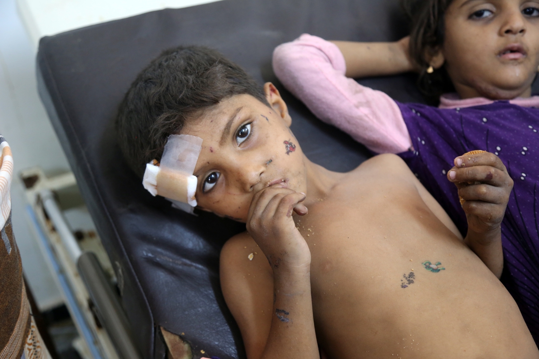 Au Yémen, des enfants victimes de la guerre