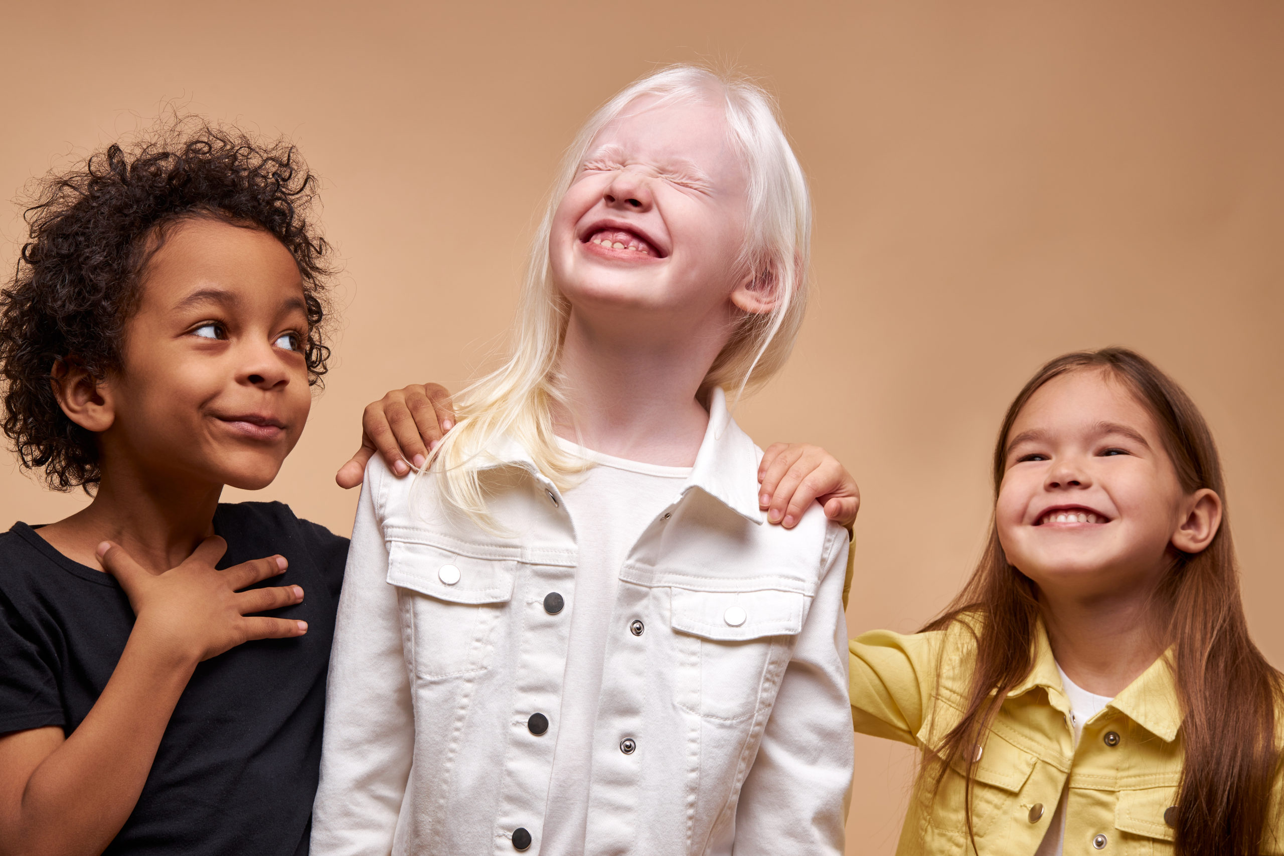 Cinq choses à savoir sur l'albinisme, cette anomalie qui affecte la peau et les yeux